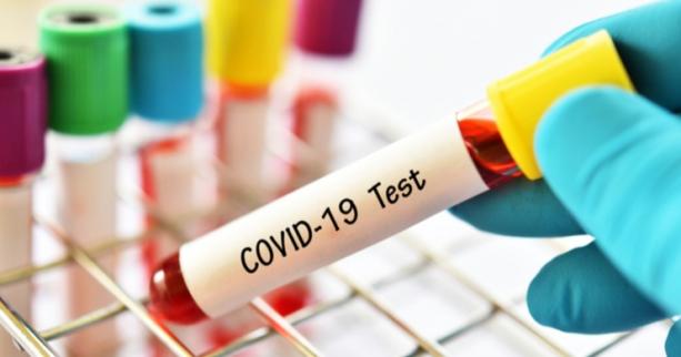 На Львівщині зафіксовано 154 нових випадки захворювання на коронавірус