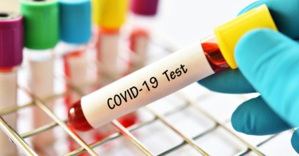 На Львівщині зафіксовано 81 новий випадок захворювання на коронавірус