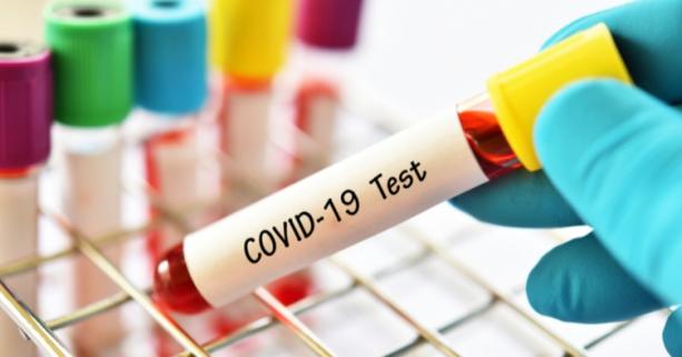 На Львівщині зафіксовано 55 нових випадків захворювання на коронавірус