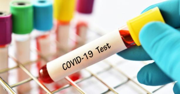 На Львівщині зафіксовано 84 нових випадки захворювання на коронавірус