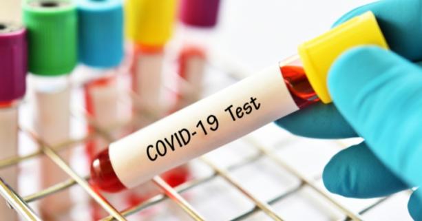 На Львівщині зафіксовано 45 нових випадків захворювання на коронавірус