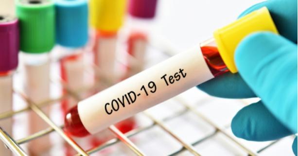 На Львівщині зафіксовано 23 нових випадки захворювання на коронавірус