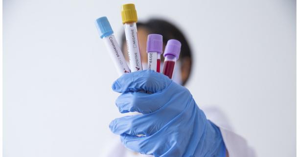 На Львівщині зафіксували 29 нових випадків захворювання на коронавірус