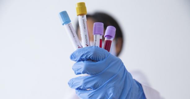 На Львівщині зафіксовано 113 нових випадків захворювання на коронавірус