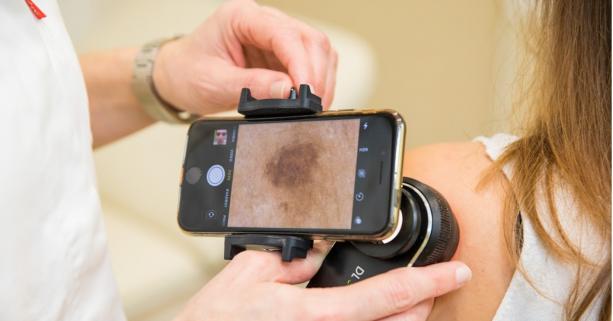 20 травня – Європейський день діагностики меланоми