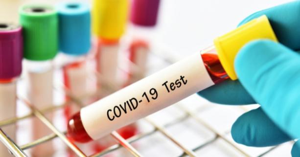 На Львівщині зафіксовано 19 нових випадків захворювання на коронавірус