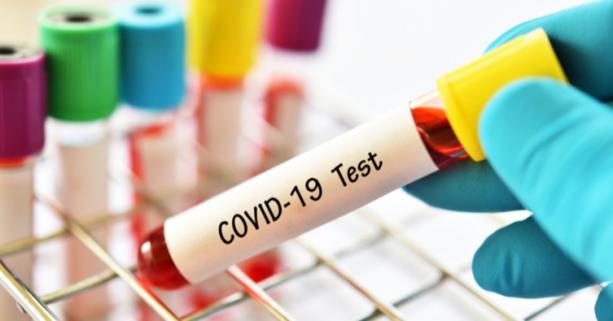 На Львівщині зафіксовано 59 нових випадків захворювання на коронавірус