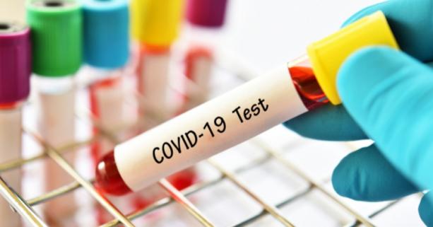 На Львівщині зафіксовано 113 нових випадків захворювання на коронавірус