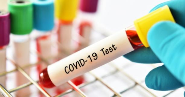 На Львівщині зафіксовано 17 нових випадків захворювання на коронавірус