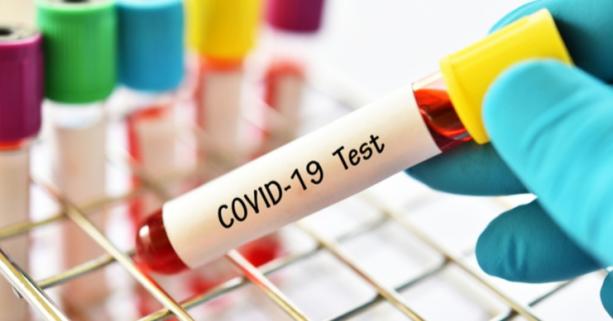 На Львівщині зафіксували 19 нових випадків захворювання на коронавірус