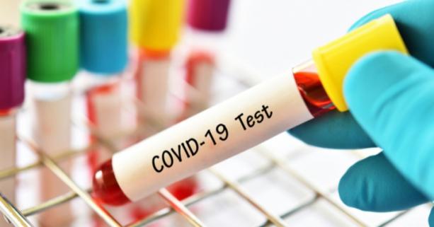 На Львівщині зафіксували 14 нових випадків захворювання на коронавірус