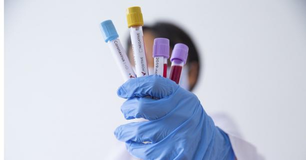 На Львівщині зафіксували 19 нових випадків захворювання на коронавірус