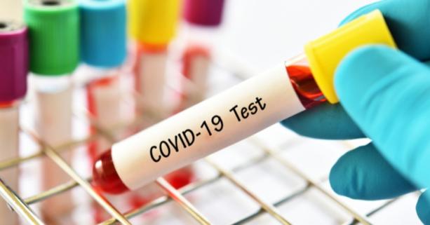 На Львівщині зафіксували 23 нових випадки захворювання на коронавірус. Госпіталізували – 21 особу